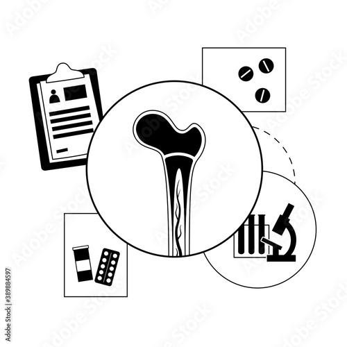 Bones template concept