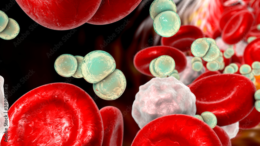 Fototapeta premium Meningococcemia, the dissemination of bacteria Nesseria meningitidis into the blood stream