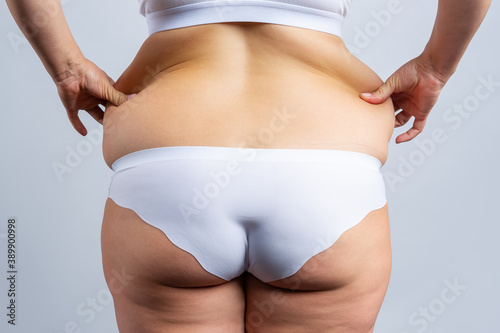Overweight woman with fat hips and buttocks, obesity female body on gray background