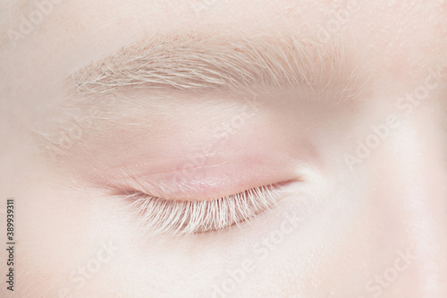 Brow and eyelid. Close up portrait of beautiful albino female model. Parts of face and body. Beauty, fashion, skincare, cosmetics, wellness concept. Copyspace. Well-kept skin, fresh look, details.