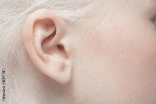 Ear. Close up portrait of beautiful albino female model. Parts of face and body. Beauty, fashion, skincare, cosmetics, wellness concept. Copyspace. Well-kept skin, fresh look, details.