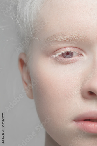 Eyes open. Close up portrait of beautiful albino female model. Parts of face and body. Beauty, fashion, skincare, cosmetics, wellness concept. Copyspace. Well-kept skin, fresh look, details.