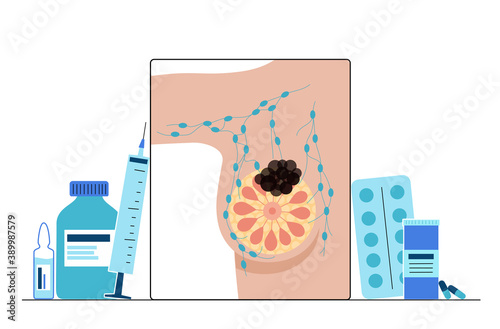 Breast disease concept