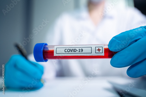 Coronavirus covid 19 infected blood vial in hand of female doctor