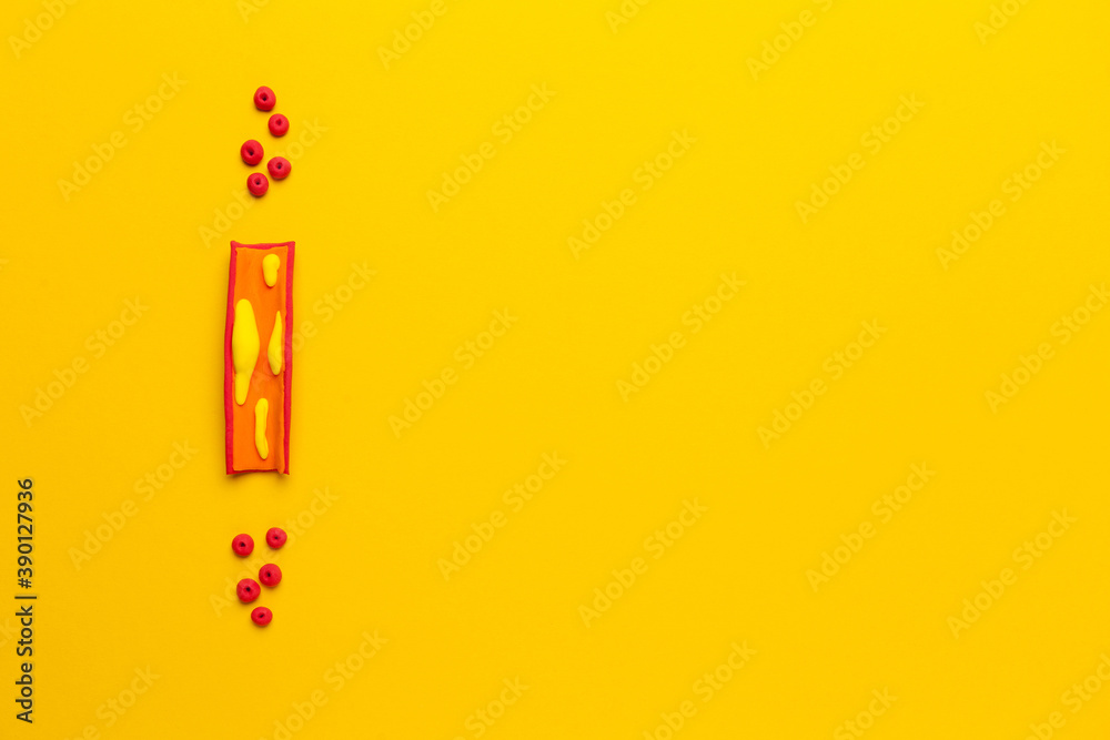 Treatment of vascular atherosclerosis, cholesterol plaques in the veins. Cartoon concept. Copy space for text. Treatment of vascular atherosclerosis, cholesterol plaques in the veins. Cartoon concept. Copy space for text.