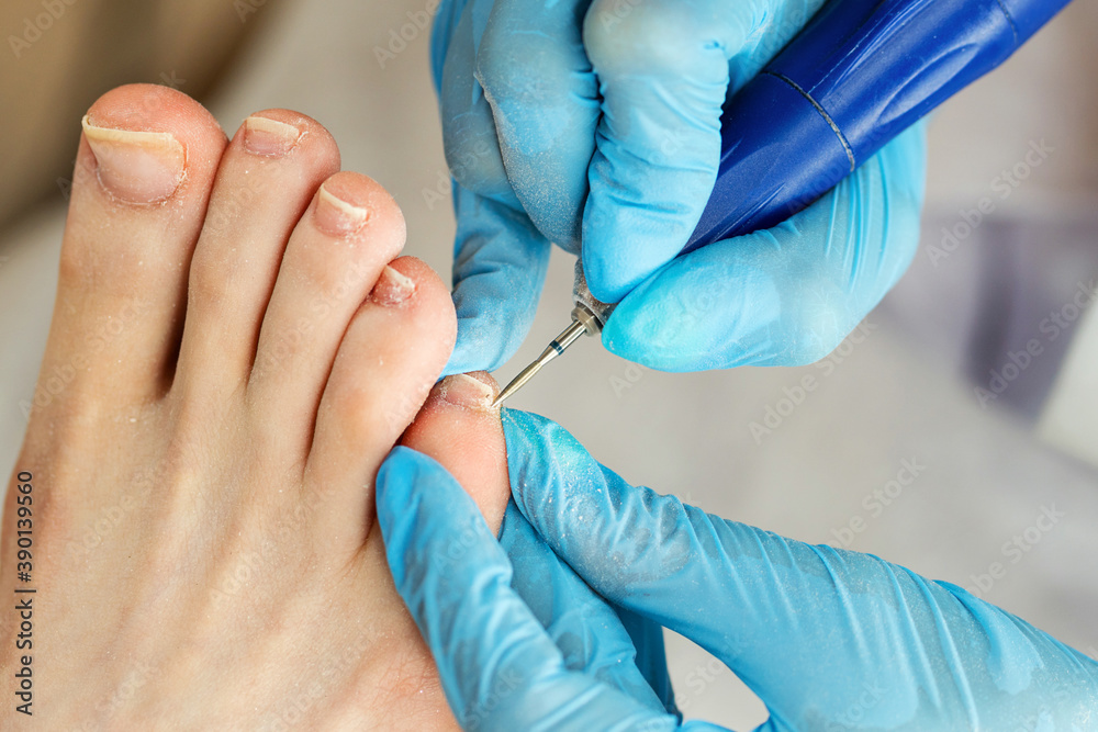Hardware pedicure, preparation of the nail plate for applying gel polish. Master chiropody