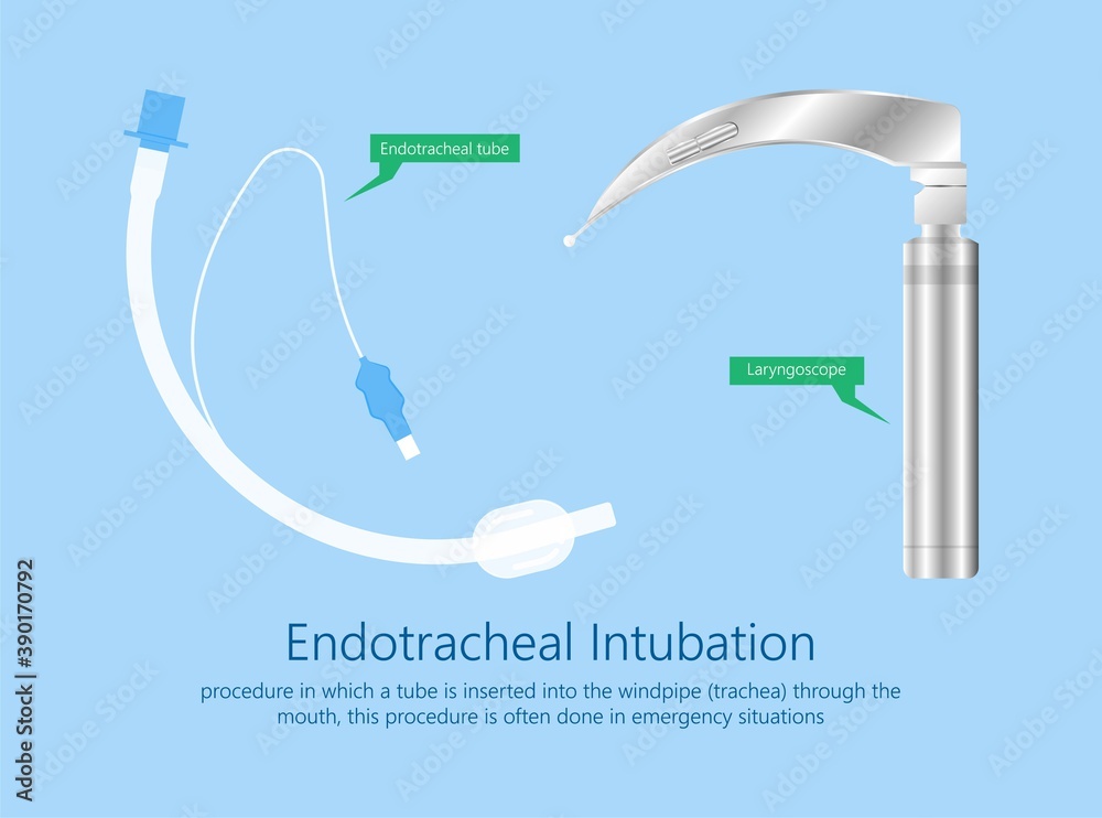 Endotracheal intubation ICU care unit COVID 19 larynx throat rescue