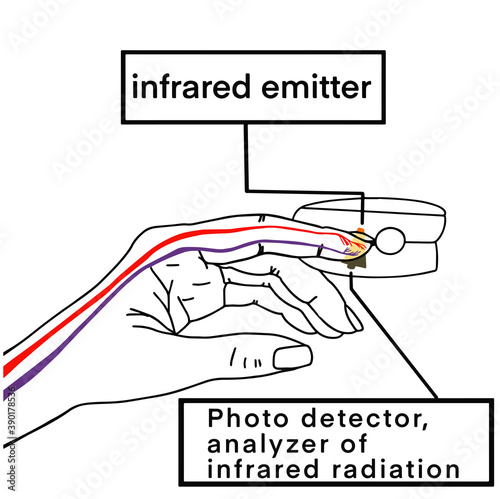 Pulse Oximeter, finger digital device to measure person's oxygen saturation. Reduced oxygenation is an emergency sign of pneumonia, for instance caused by coronavirus. . Vector illustration eps10.