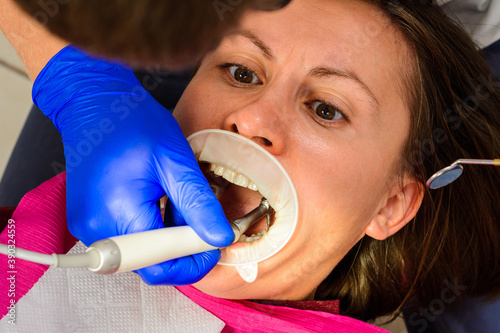 Patient and dentist, examination and treatment of masticatory teeth, removal of old fillings, use of a retractor. photo