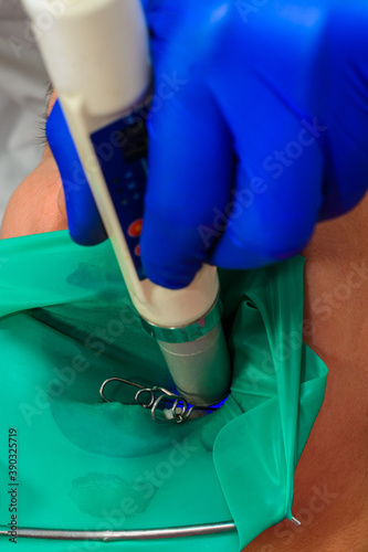 The dentist uses ultraviolet light when filling teeth, light blue.