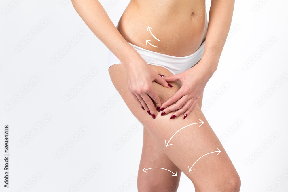 Cellulite removal scheme. White arrows markings on legs and belly young girl.