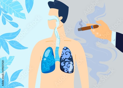 Smoking lung damage vector illustration. Cartoon flat damaged with nicotine cigarettes, tobacco respiratory system on medical poster, healthy and cancer diseased smokers lungs, medicine background