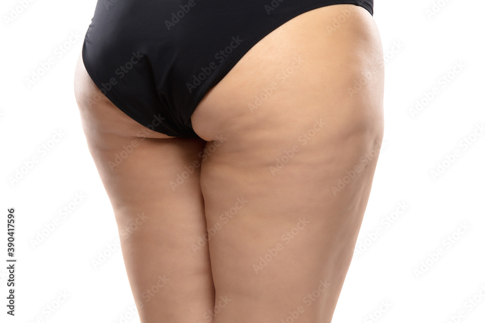 Fototapeta premium Back view. Overweight woman with fat cellulite legs and buttocks, obesity female body in black underwear isolated on white background. Orange peel skin, liposuction, healthcare and beauty treatment.