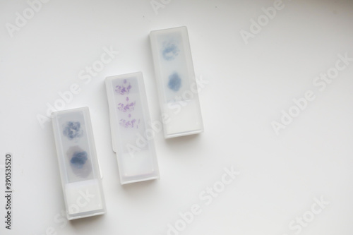 Close up photo of boxes with glass with histological and immunohistochemical brain tissue samples. Top view, copy space