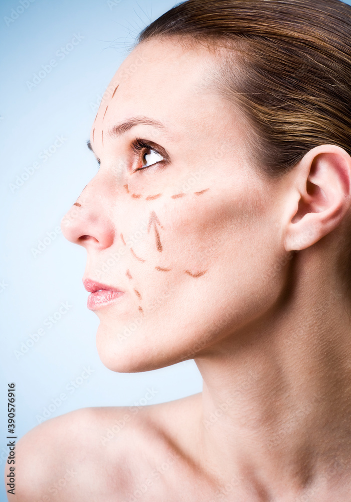 Woman's face with correction lines drawn for lifting procedure in surgery. Studio photo in blue background. Woman's face with correction lines drawn for lifting procedure in surgery. Studio photo in blue background.