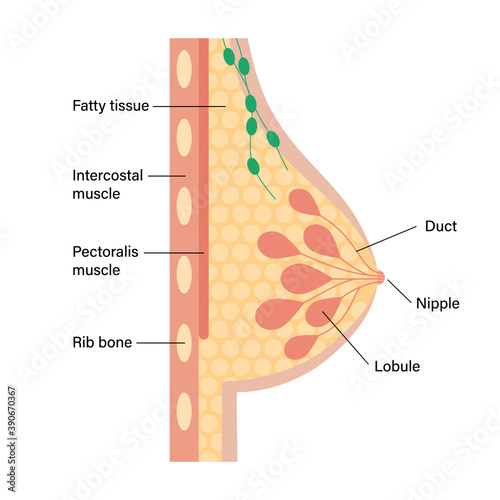 Breast disease concept