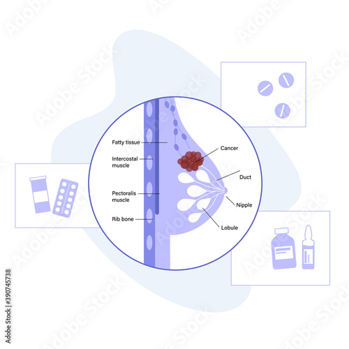 Breast disease concept