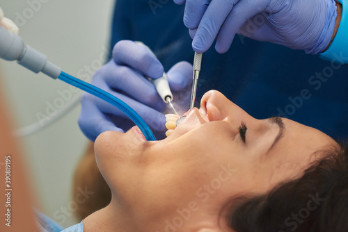 Detail plane of dental cleaning.