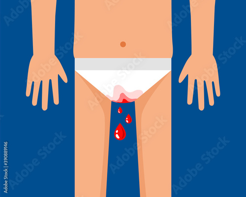blood flow from the ginetals. blood-stained underpants. flat vector illustration.