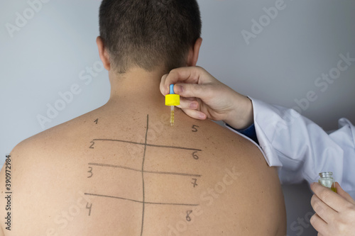 Papier peint An allergist in the laboratory conducts an allergy prick-test