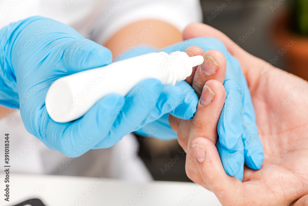 A dermatologist uses drops to treat a sick patient. Examination and diagnosis of skin diseases-allergies, psoriasis, eczema, dermatitis A dermatologist uses drops to treat a sick patient. Examination and diagnosis of skin diseases-allergies, psoriasis, eczema, dermatitis