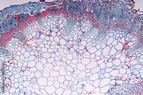 Zygomycota, or zygote fungi ,Downy mildew of cruzifers host tissue with conidia living in decaying plant on Slide under the microscope for education. 