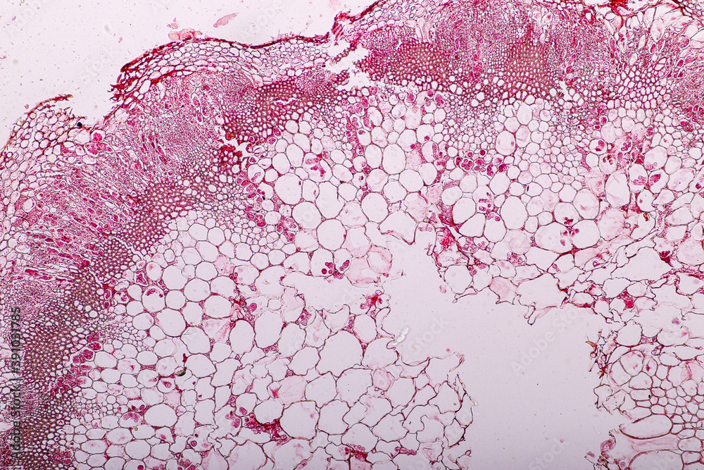 Zygomycota, or zygote fungi ,Downy mildew of cruzifers host tissue with  conidia living in decaying plant on Slide under the microscope for  education. фотография Stock | Adobe Stock