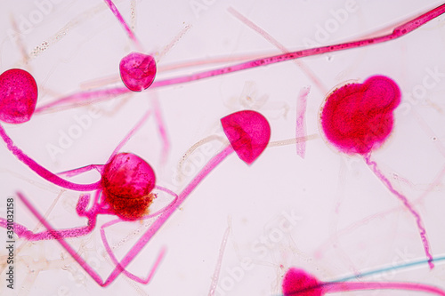  Characteristics of Rhizopus is a genus of common saprophytic fungi  on Slide under the microscope for education.
 photo