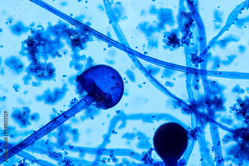  Characteristics of Rhizopus is a genus of common saprophytic fungi on Slide under the microscope for education. 