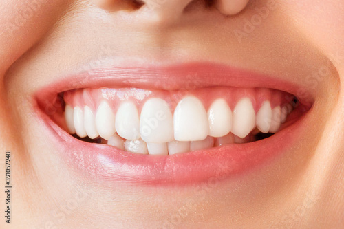 Perfect healthy teeth smile of a young woman. Teeth whitening. Dental care  stomatology concept.