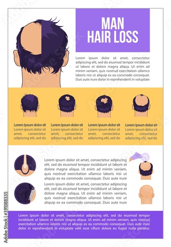 Man hairloss problem flat illustration Baldness stages