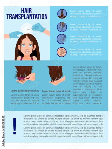 Woman Hairloss Flat Illustration infographic Medical problem