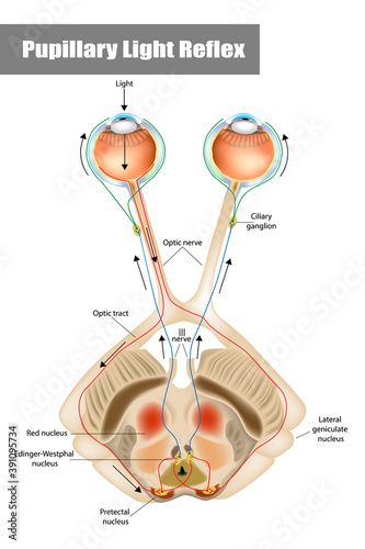 Pupillary light reflex PLR or photopupillary reflex. Schematic drawing of the pupillary light reflex pathway.