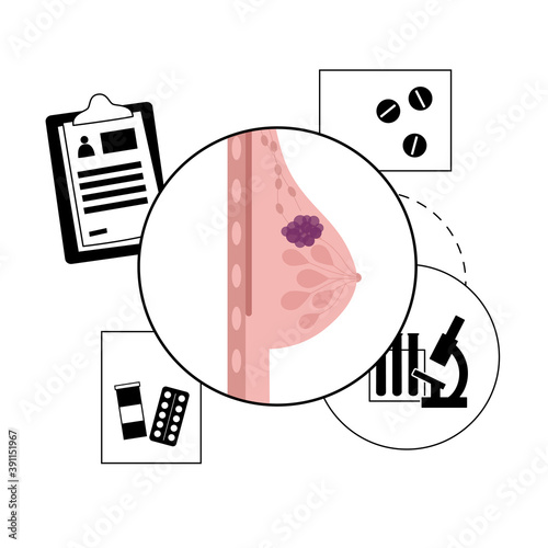 Breast disease concept