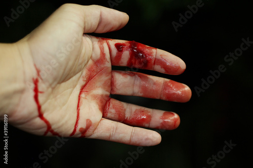 Canvas-taulu Close up hand injury, Finger cut with knife, real bloody hand