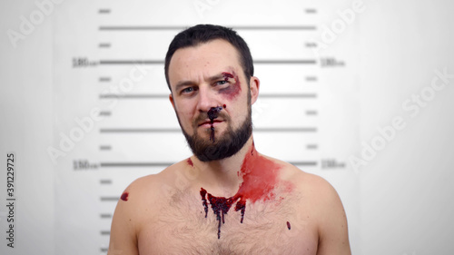 Valokuva Arrested young beaten man posing for front view mugshot.