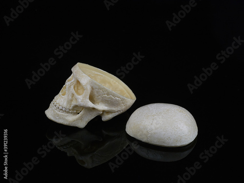 Human skull without the top of the head, which lies nearby on a black background, a symbol of the problem, disease