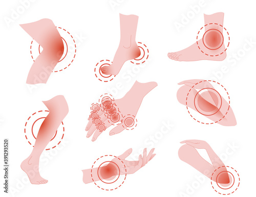 Set of painful leg and hand concept with pain red circle cartoon flat design vector illustration on white background