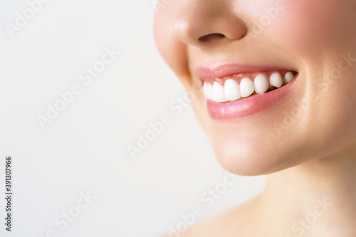 Perfect healthy teeth smile of a young woman. Teeth whitening. Dental clinic patient. Image symbolizes oral care dentistry, stomatology