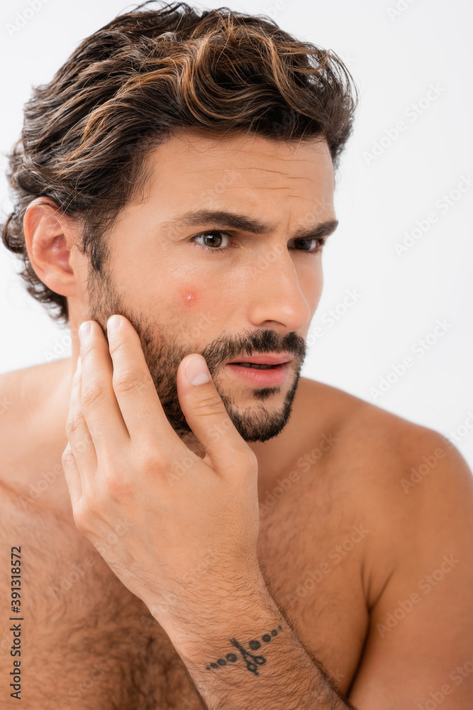 Obraz premium Worried man with acne on cheek isolated on grey