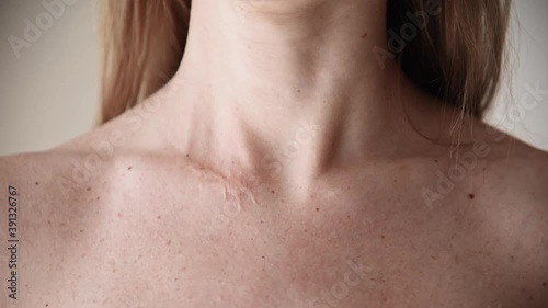 Wallpaper Mural Close up surgery scar on beautiful woman neck. Torontodigital.ca