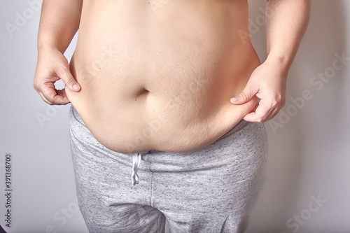 female belly after childbirth, excess fat and stretched skin