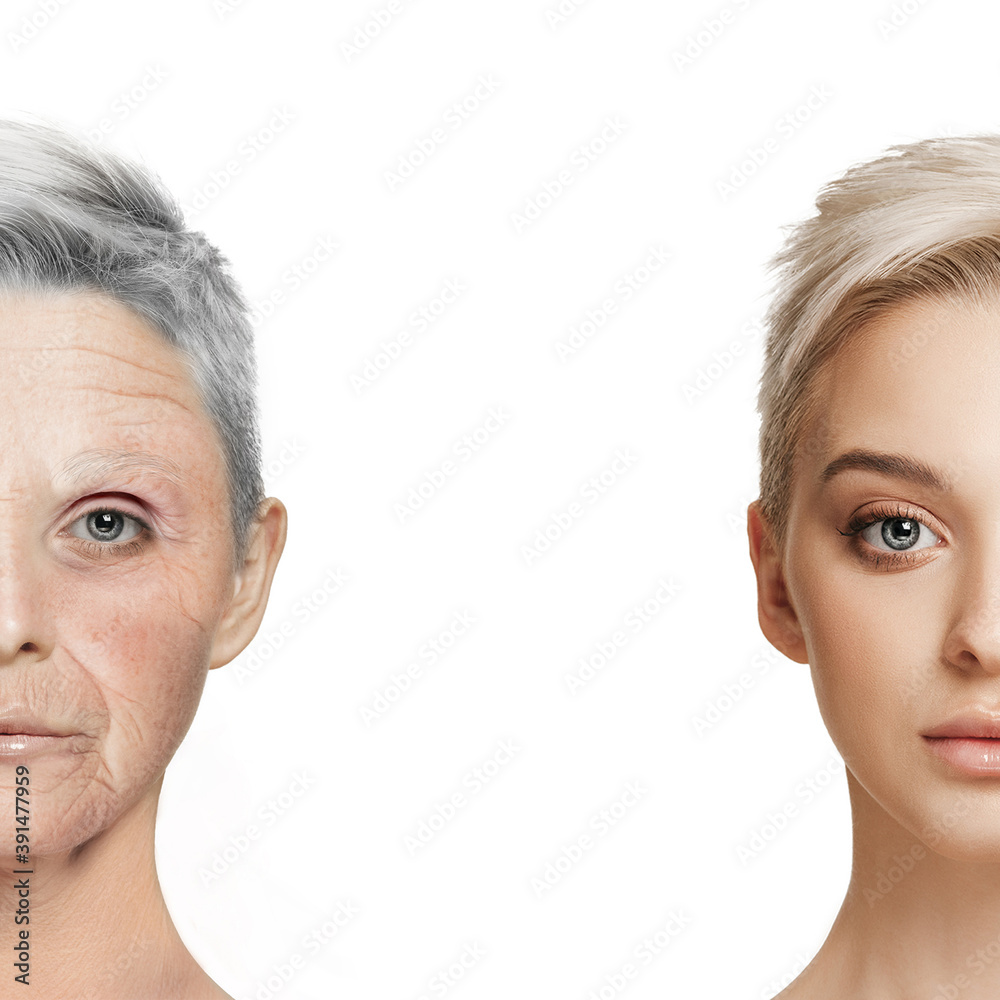 Comparison. Portrait of beautiful woman with problem and clean skin ...