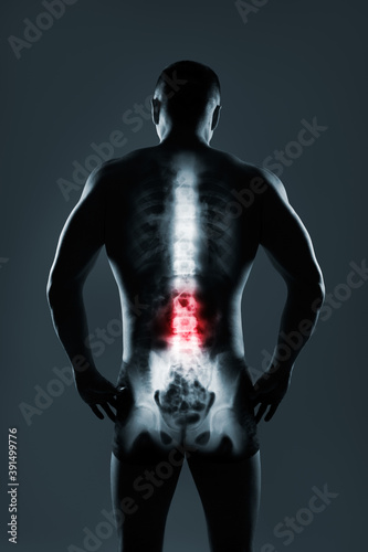Fototapeta Naklejka Na Ścianę i Meble -  Human spine in x-ray on gray background.