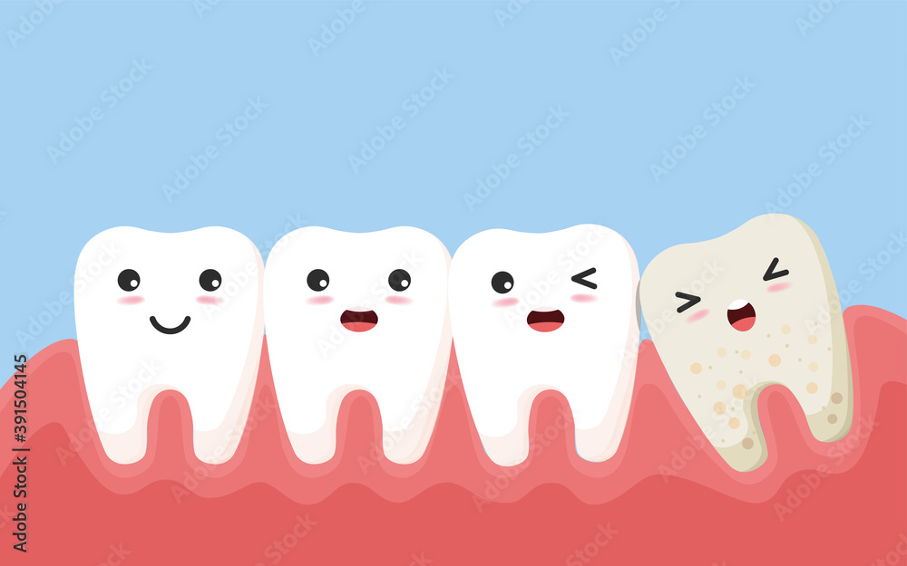 Fototapeta premium Wisdom tooth push other tooth Concept.