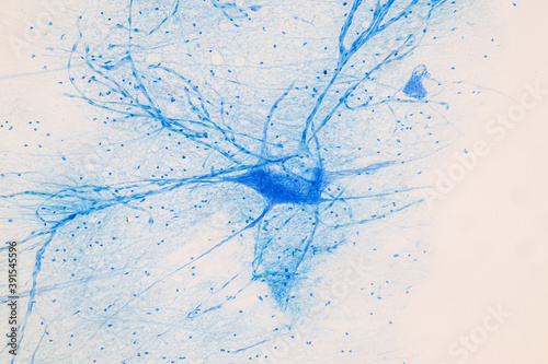 Education Spinal cord  and Motor Neuron under the microscope in Lab.
 photo