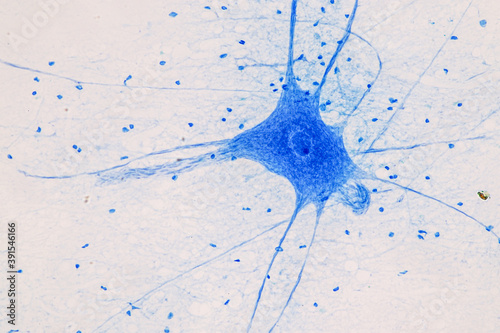 Education Spinal cord  and Motor Neuron under the microscope in Lab.
 photo