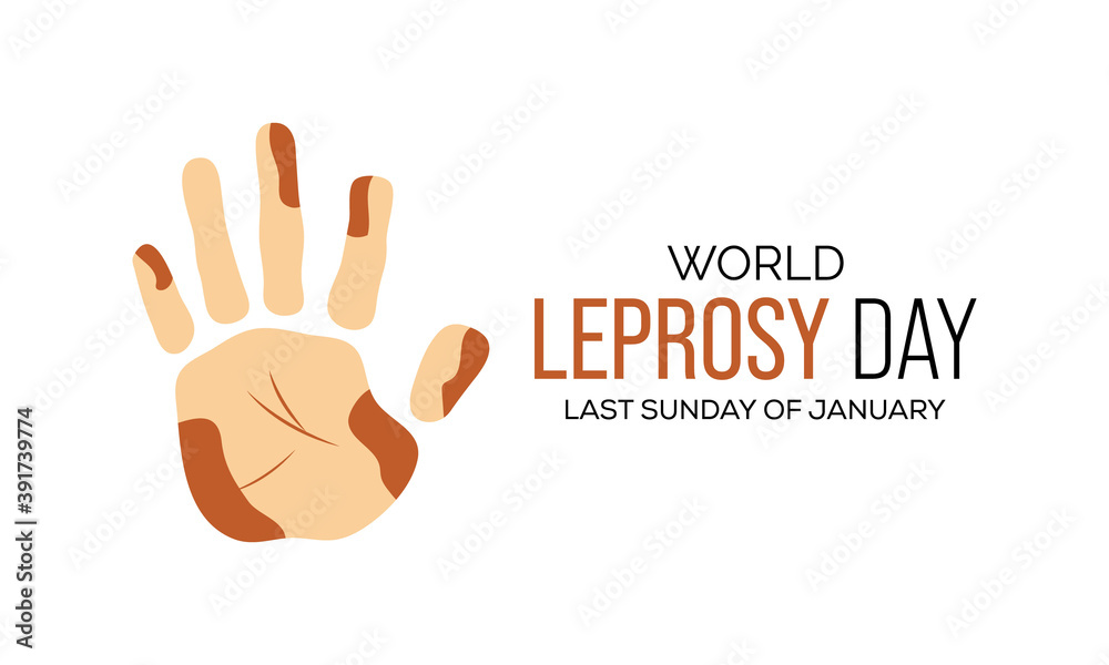 Vector illustration on the theme of World Leprosy Eradication or Hansen's disease day observed each year on last Sunday of January across the globe. Vector illustration on the theme of World Leprosy Eradication or Hansen's disease day observed each year on last Sunday of January across the globe.