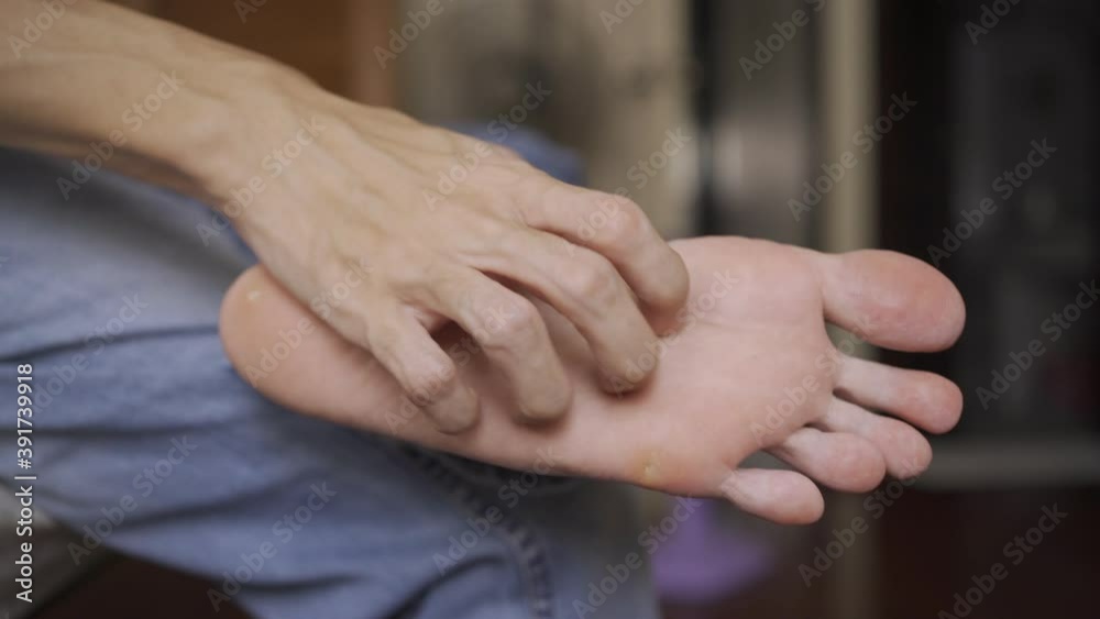 hand scratching itchy foot sole hand scratching itchy foot sole