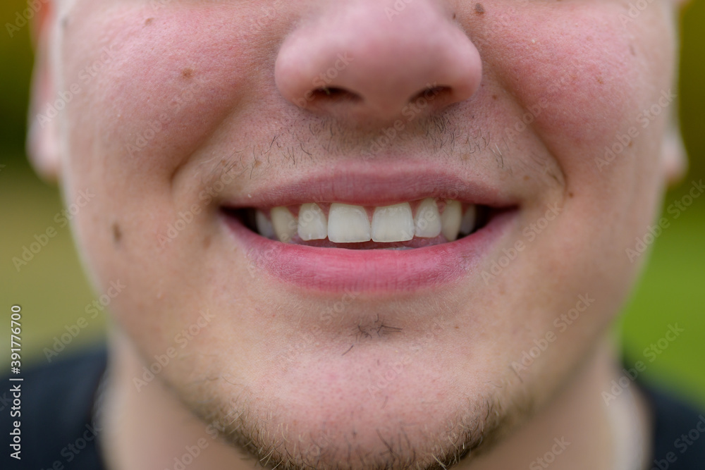 Close up on the teeth of a smiling young man Close up on the teeth of a smiling young man